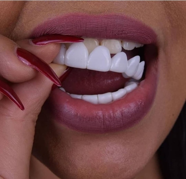 Фото: Инновационные виниры для зубов Perfect Smile Veneers <br>Цена 1290 руб <br>Подробней под фото